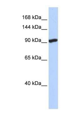 Western Blot: SIDT2 Antibody [NBP1-91551] - Titration: 0.2-1 ug/ml, Positive Control: Hela cell lysate.