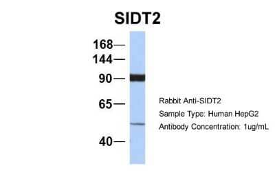 Western Blot: SIDT2 Antibody [NBP1-91551] - Sample Type: HepG2 Antibody Dilution: 1.0 ug/ml SIDT2 is strongly supported by BioGPS gene expression data to be expressed in Human HepG2 cells