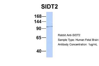 Western Blot: SIDT2 Antibody [NBP1-91551] - Sample Type: Human Fetal Brain Antibody Dilution: 1.0 ug/ml