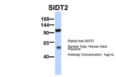 Western Blot: SIDT2 Antibody [NBP1-91551] - Sample Type: Human Adult Placenta Antibody Dilution: 1.0 ug/ml