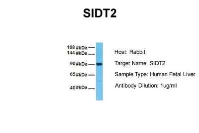 Western Blot: SIDT2 Antibody [NBP1-91551] - Sample Tissue: Human Fetal Liver Antibody Dilution: 1.0 ug/ml