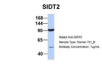 Western Blot: SIDT2 Antibody [NBP1-91551] - Sample Type: 721_B Antibody Dilution: 1.0 ug/ml SIDT2 is supported by BioGPS gene expression data to be expressed in 721_B