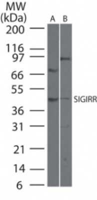 Western Blot: SIGIRR Antibody [NB100-56650] - analysis of SIGIRR in 40 ugs of A) HCT-116 and B) A549 cell lysate using this antibody.