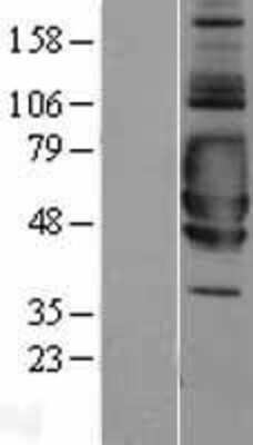 Western Blot: SIGIRR Overexpression Lysate (Adult Normal) [NBL1-15956] Left-Empty vector transfected control cell lysate (HEK293 cell lysate); Right -Over-expression Lysate for SIGIRR.