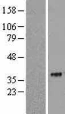 Western Blot: SIGLEC15 Overexpression Lysate (Adult Normal) [NBL1-15959] Left-Empty vector transfected control cell lysate (HEK293 cell lysate); Right -Over-expression Lysate for SIGLEC15.