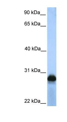 Western Blot: SIGLECL1 Antibody [NBP1-59242] - HepG2 cell lysate, concentration 0.2-1 ug/ml.