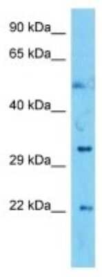 Western Blot: SIGNR3/CD209d Antibody [NBP3-10192] - Western blot analysis of SIGNR3/CD209d in Mouse SP2/0 Whole Cell lysates. Antibody dilution at 1ug/ml