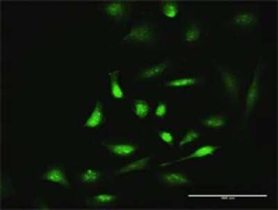 Immunocytochemistry/ Immunofluorescence SIK1/Snf1lk Antibody