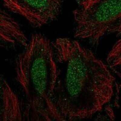 Immunocytochemistry/Immunofluorescence: SIK1/Snf1lk Antibody [NBP3-17767] - Staining of human cell line SiHa shows localization to nucleoplasm.