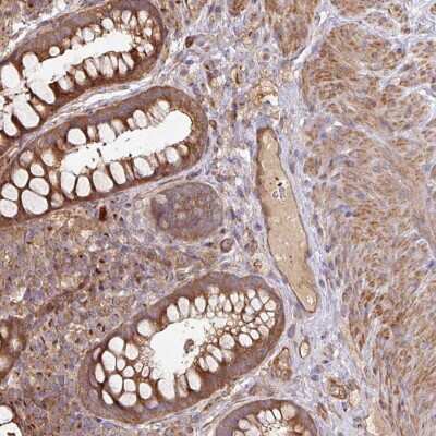 Immunohistochemistry: SIK1/Snf1lk Antibody [NBP2-38397] - Staining of human rectum shows strong cytoplasmic positivity in glandular cells.