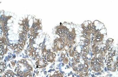 Immunohistochemistry-Paraffin: SIK1/Snf1lk Antibody [NBP1-53156] - Human Stomach Tissue, Surface mucous cells and Epithelial cells of funic gland (Indicated with Arrows) 4-8ug/ml.