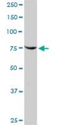 Western Blot SIK1/Snf1lk Antibody