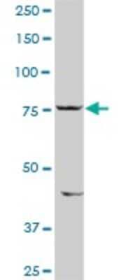 Western Blot: SIK1/Snf1lk Antibody [H00150094-D01P] - Analysis of SIK1 expression in mouse lung.