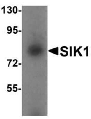 Western Blot: SIK1/Snf1lk Antibody [NBP1-76571] - Human small intestine tissue lysate with SIK1/Snf1lk  antibody at 1 ug/mL.