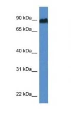 Western Blot: SIK1/Snf1lk Antibody [NBP1-82417] - Titration: 1.0 ug/ml Positive Control: Rat Lung.
