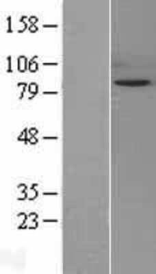Western Blot: SIK1/Snf1lk Overexpression Lysate (Adult Normal) [NBL1-16278] Left-Empty vector transfected control cell lysate (HEK293 cell lysate); Right -Over-expression Lysate for SIK1/Snf1lk.