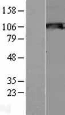 Western Blot: SIK2 Overexpression Lysate (Adult Normal) [NBL1-16279] Left-Empty vector transfected control cell lysate (HEK293 cell lysate); Right -Over-expression Lysate for SIK2.