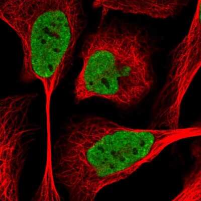 Immunocytochemistry/Immunofluorescence: SIK3 Antibody [NBP2-47277] - Immunofluorescent staining of human cell line U-2 OS shows localization to nucleoplasm.