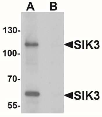 Western Blot: SIK3 Antibody [NBP2-41147] - Western blot analysis of SIK3 in rat brain tissue lysate with SIK3 antibody at 1 ug/mL in (A) the absence and (B) the presence of blocking peptide.