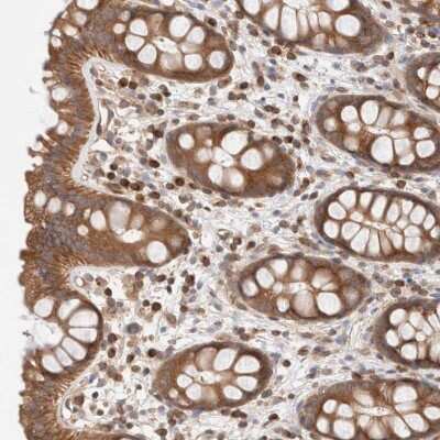 Immunohistochemistry-Paraffin SIKE1 Antibody - BSA Free