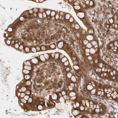 Immunohistochemistry-Paraffin SIKE1 Antibody