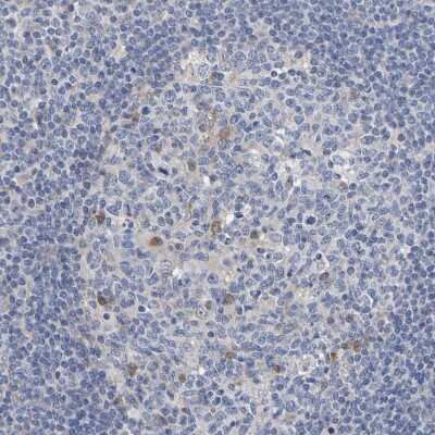 Immunohistochemistry-Paraffin: SIL1 Antibody [NBP1-88713] - Staining of human tonsil shows very weak positivity in germinal center cells.