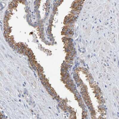 Immunohistochemistry-Paraffin: SIL1 Antibody [NBP1-88713] - Staining of human prostate shows moderate  granular cytoplasmic positivity in glandular cells.