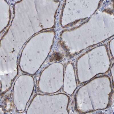 Immunohistochemistry-Paraffin: SIL1 Antibody [NBP1-88713] - Staining of human thyroid gland shows moderate granular cytoplasmic positivity in glandular cells.