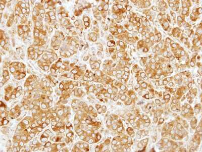 Immunohistochemistry-Paraffin: SIL1 Antibody [NBP2-20365] - Immunohistochemical analysis of paraffin-embedded MCF7 xenograft, using antibody at 1:250 dilution.