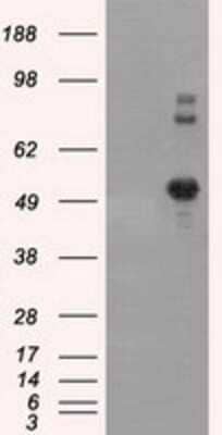 Western Blot: SIL1 Antibody (OTI3E3) - Azide and BSA Free [NBP2-74193] - HEK293T cells were transfected with the pCMV6-ENTRY control (Left lane) or pCMV6-ENTRY SIL1 (Right lane) cDNA for 48 hrs and lysed. Equivalent amounts of cell lysates (5 ug per lane) were separated by SDS-PAGE and immunoblotted with anti-SIL1.