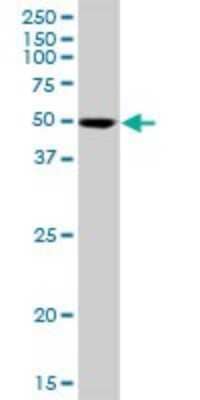 Western Blot: SIL1 Antibody [H00064374-B01P] - Analysis of SIL1 expression in LNCaP.