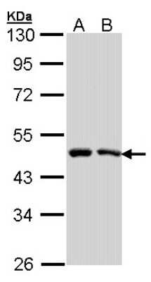 Western Blot: SIL1 Antibody [NBP2-20363] - Sample (30 ug of whole cell lysate) A: A431 B: H1299 10% SDS PAGE gel, diluted at 1:1000.