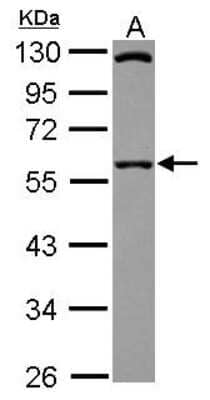 Western Blot: SIL1 Antibody [NBP2-20364] - Sample (30 ug of whole cell lysate) A: A431 10% SDS PAGE gel, diluted at 1:5000.