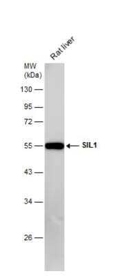 Western Blot: SIL1 Antibody [NBP2-20364] - Rat tissue extract (50 ug) was separated by 10% SDS-PAGE, and the membrane was blotted with SIL1 antibody [N1C2] diluted at 1:5000.