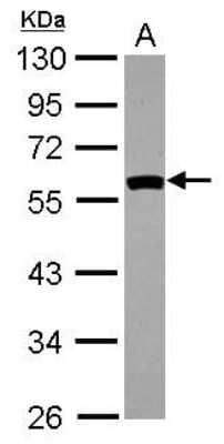 Western Blot: SIL1 Antibody [NBP2-20365] - Sample (30 ug of whole cell lysate) A: A431 10% SDS PAGE gel, diluted at 1:5000.