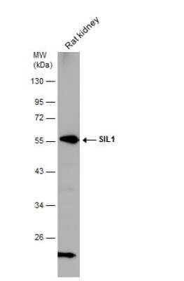 Western Blot: SIL1 Antibody [NBP2-20365] - Rat tissue extract (50 ug) was separated by 10% SDS-PAGE, and the membrane was blotted with SIL1 antibody [N1N3] diluted at 1:5000.