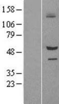 Western Blot: SIL1 Overexpression Lysate (Adult Normal) [NBL1-15966] Left-Empty vector transfected control cell lysate (HEK293 cell lysate); Right -Over-expression Lysate for SIL1.