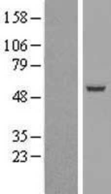 Western Blot: SIL1 Overexpression Lysate (Adult Normal) [NBL1-15967] Left-Empty vector transfected control cell lysate (HEK293 cell lysate); Right -Over-expression Lysate for SIL1.