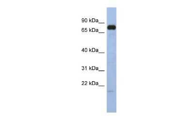 Western Blot: SIM1 Antibody [NBP2-84261] - WB Suggested Anti-SIM1 Antibody Titration: 0.2-1 ug/ml. ELISA Titer: 1:312500. Positive Control: Human Stomach