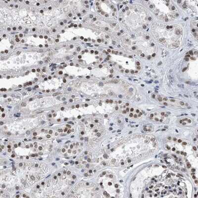 Immunohistochemistry-Paraffin: SIM2 Antibody [NBP1-88619] - Staining of human Kidney shows moderate nuclear positivity in cells in glomeruli and tubules.