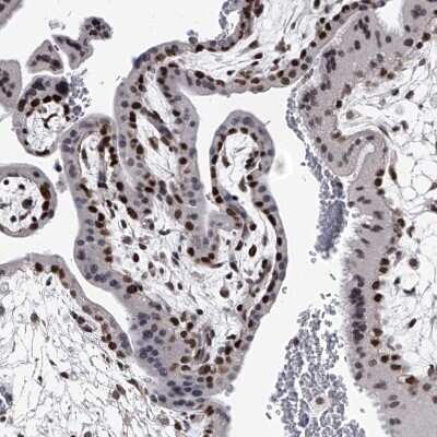 Immunohistochemistry-Paraffin: SIM2 Antibody [NBP1-88619] - Staining of human Placenta shows strong nuclear positivity in trophoblastic cells.