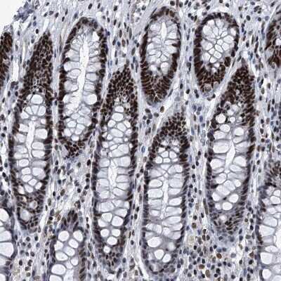 Immunohistochemistry-Paraffin: SIM2 Antibody [NBP1-88619] - Staining of human Rectum shows strong nuclear positivity in glandular cells.