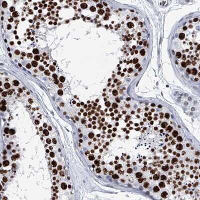Immunohistochemistry-Paraffin: SIM2 Antibody [NBP1-88619] - Staining of human Testis shows strong nuclear positivity in cells in seminiferous ducts.