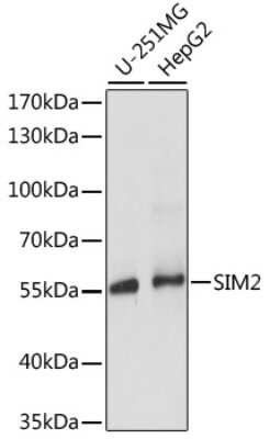 Western Blot: SIM2 Antibody [NBP2-95173] - Analysis of extracts of various cell lines, using SIM2 at 1:1000 dilution. Secondary antibody: HRP Goat Anti-Rabbit IgG (H+L) at 1:10000 dilution. Lysates/proteins: 25ug per lane. Blocking buffer: 3% nonfat dry milk in TBST. Detection: ECL Basic Kit . Exposure time: 5s.