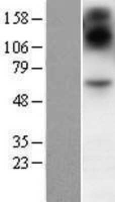 Western Blot: SIM2 Overexpression Lysate (Adult Normal) [NBP2-07499] Left-Empty vector transfected control cell lysate (HEK293 cell lysate); Right -Over-expression Lysate for SIM2.