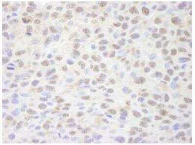 Immunohistochemistry-Paraffin: SIN3A Antibody [NB100-2252] - FFPE section of mouse squamous cell carcinoma.  Rabbit anti-SIN3A Antibody used at a dilution of 1:250.