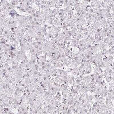 Immunohistochemistry-Paraffin: SIN3A Antibody [NBP2-38564] - Staining of human liver shows low expression as expected.