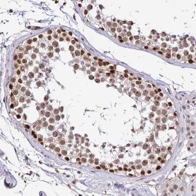 Immunohistochemistry-Paraffin: SIN3A Antibody [NBP2-38564] - Staining of human testis shows moderate to strong nuclear positivity in cells in seminiferous ducts.