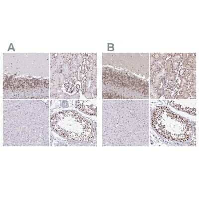 Immunohistochemistry-Paraffin: SIN3A Antibody [NBP2-38949] - Staining of human cerebellum, kidney, liver and testis using Anti-SIN3A antibody NBP2-38949 (A) shows similar protein distribution across tissues to independent antibody NBP2-38564 (B).