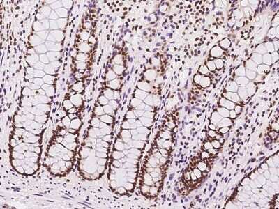 Immunohistochemistry-Paraffin: SIN3A Antibody [NBP2-98964] - Immunochemical staining of human SIN3A in human duodenum with rabbit polyclonal antibody at 1:300 dilution, formalin-fixed paraffin embedded sections.